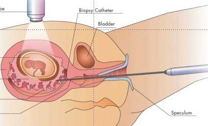 「dna鉴定」dna鉴定的小窍门你能好多个? 「dna鉴定」dna鉴定的小窍门你能好多个?