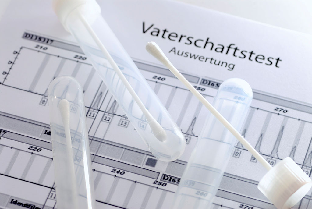 成都做个无创dna亲子鉴定需要多少钱? 成都做个无创dna亲子鉴定需要多少钱?