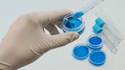 南宁个人dna鉴定怎样采集标本? 南宁个人dna鉴定怎样采集标本?