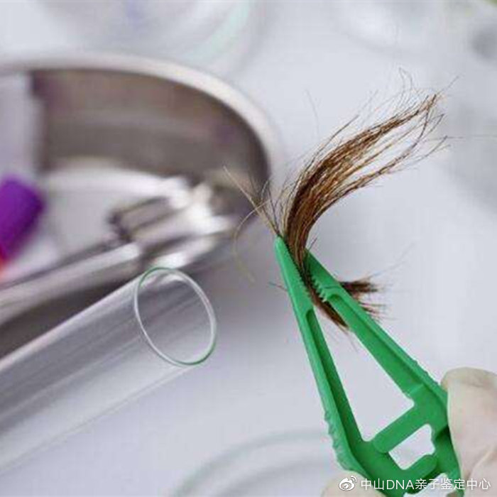 胎儿dna鉴定